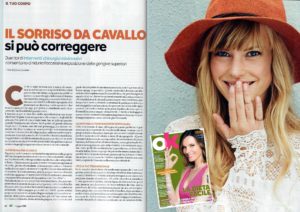 Gummy Smile - Ok SAlute e benessere