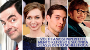 mento retruso - famosi