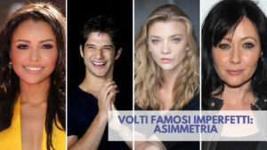 Asimmetria facciale - Famosi